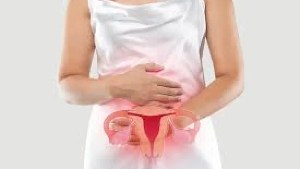 Menyingkap Endometriosis: Kondisi yang Sering Diabaikan dan Pentingnya Penanganannya