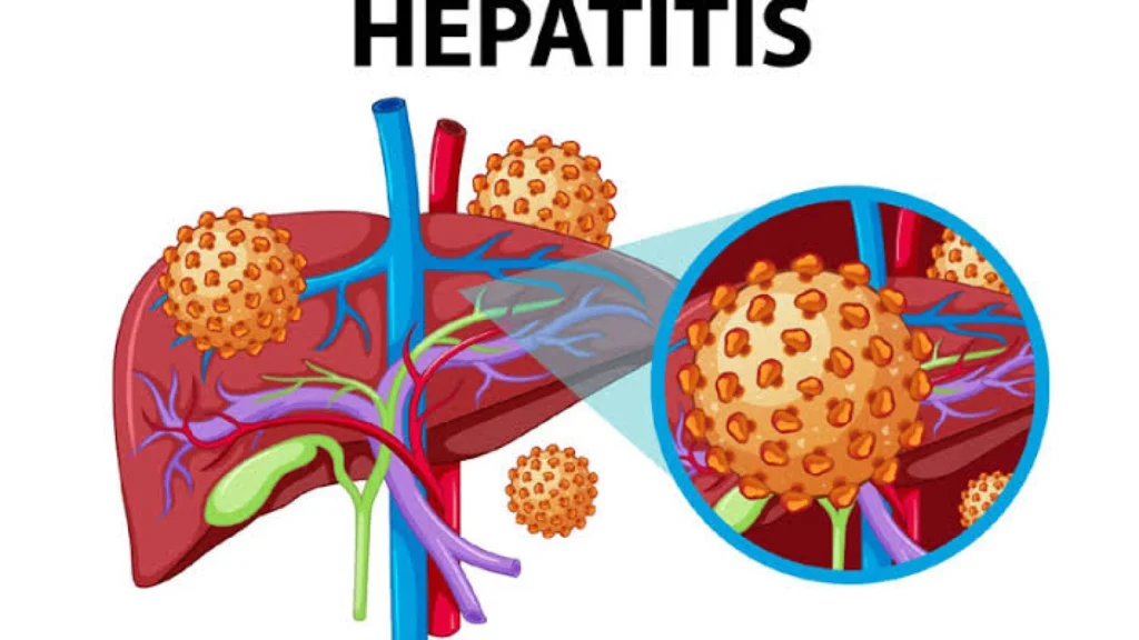 Meningkatkan Kesadaran Tentang Hepatitis di Hari Hepatitis Sedunia